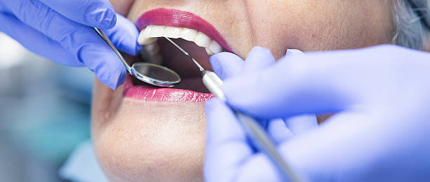 Best Dentist for Tooth Abscess  in Rshfield Hills, MA